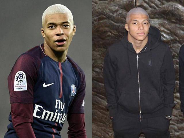 阿方索·戴维斯：本轮欧冠我将迎来复出，不确定是否能上场